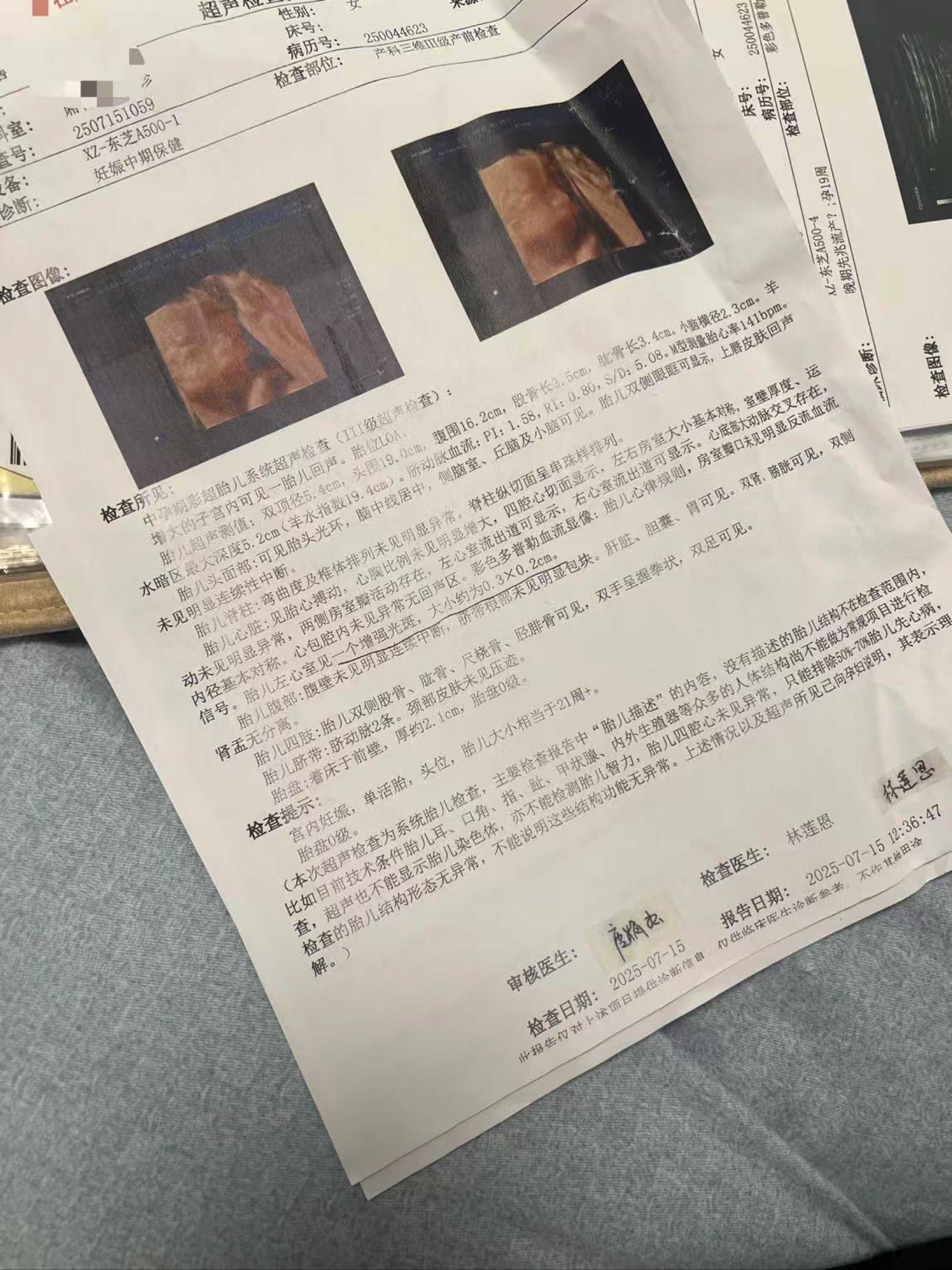 白云新市 真实 转运珠 小傻瓜